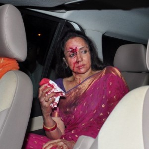 Hema Malini after the accident