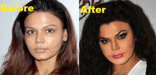 actress and plastic surgery