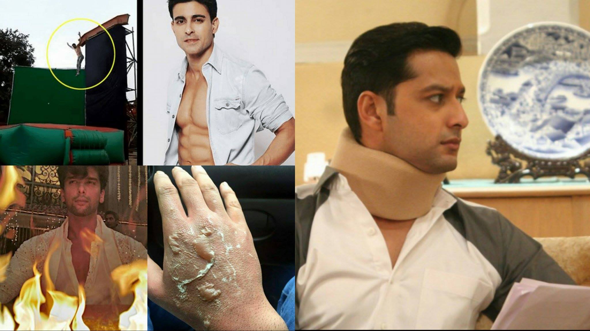 17 Tv Actors Who Got Injured On The Sets Filmymantra