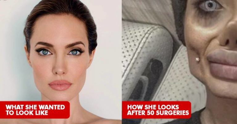 This Woman Underwent 50 Surgeries To Look Like Angelina Jolie. She ...