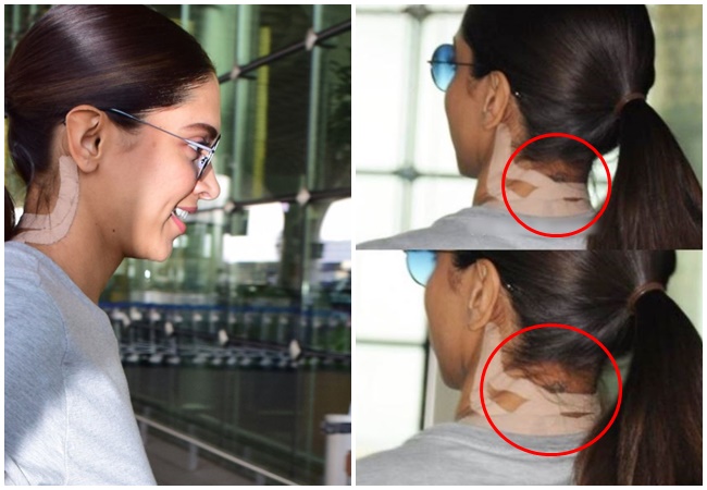 Did Deepika just get her Ranbir Kapoor tattoo removed?