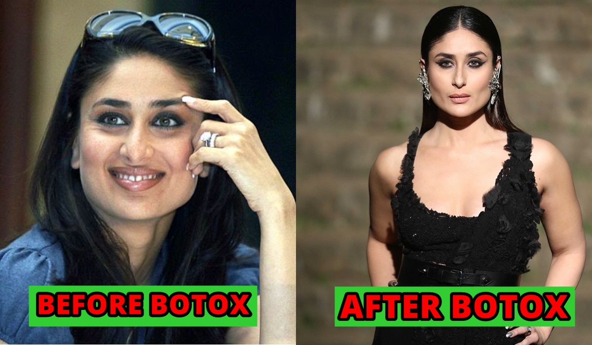 Kareena Kapoor Khan-BOTOX TREATMENT