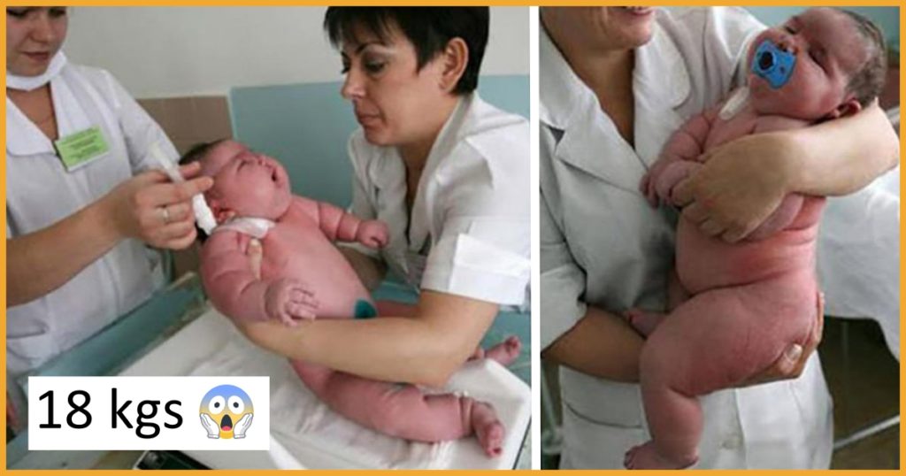 Woman Gives Birth To The Heaviest Baby In The World Weighing Kgs Filmymantra