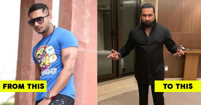 Shocking Transformation Of Yo Yo Honey Singh He Looks Unrecognizable 